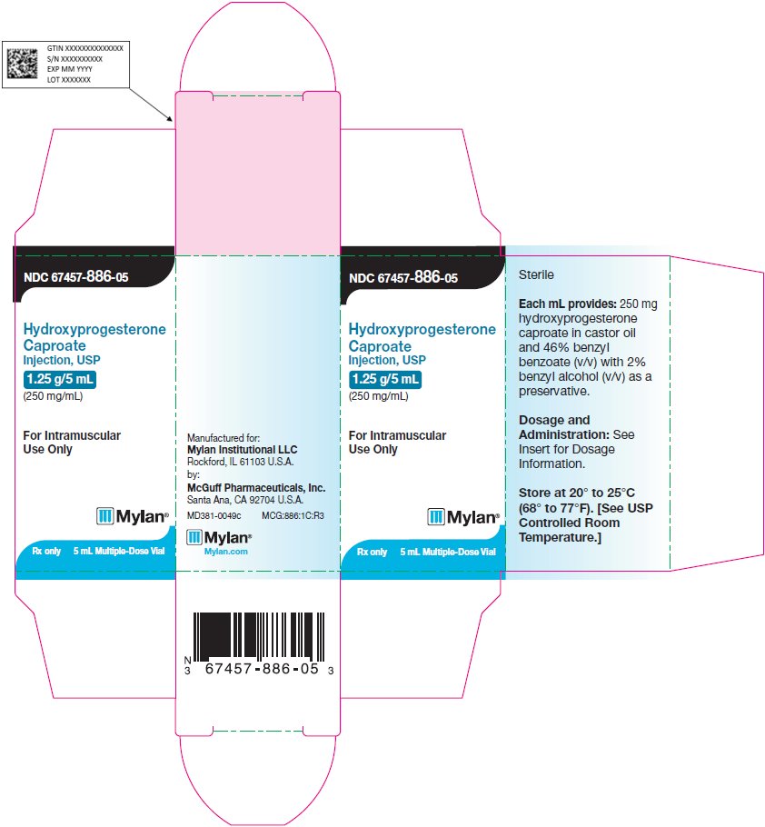Hydroxyprogesterone Caproate Injection 1.25 g/5 mL Carton Label