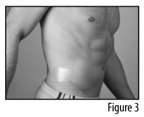 Applying a Fentanyl Transdermal System (Figure #3)