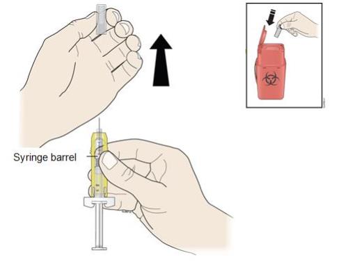 Hold the prefilled syringe by the syringe barrel.  Carefully pull the gray needle cap straight off and away from your body. 