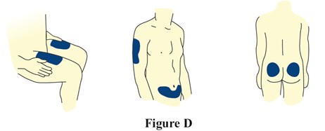 Figure D