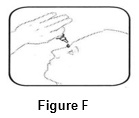 Instructions for Use - Figure F