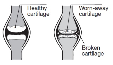 cartilage