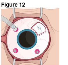 Figure 12