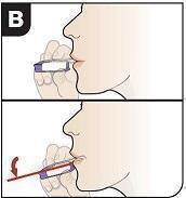 Image of inhaler position in mouth