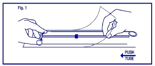 Illustration of pushing the insertion tube agains the ParaGard arms to start bending them