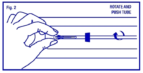 Illustration of securing the ParaGard arms in the insertion tube