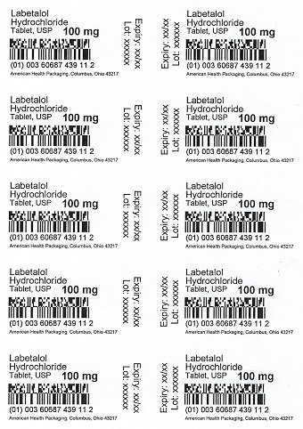 100 mg Labetalol HCl Tablet Blister