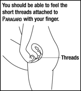Paragard