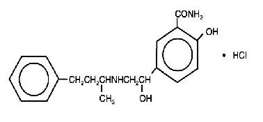 Labetalol structural formula