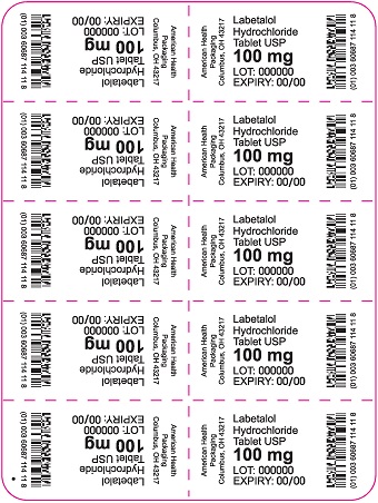 100 mg Labetalol HCl Tablet Blister