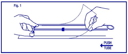 If you do not have sterile gloves, you can do STEPS 1 and 2 while ParaGard® is in the sterile package. First, place the package face up on a clean surface. Next, open at the bottom end (where arrow says OPEN). Pull the solid white rod partially from the package so it will not interfere with assembly. Place thumb and index finger on top of package on ends of the horizontal arms. Use other hand to push insertion tube against arms of ParaGard® (shown by arrow in Fig. 1). This will start bending the T arms.