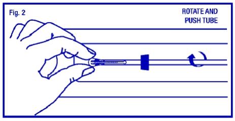 Bring the thumb and index finger closer together to continue bending the arms until they are alongside the stem. Use the other hand to withdraw the insertion tube just enough so that the insertion tube can be pushed and rotated onto the tips of the arms. Your goal is to secure the tips of the arms inside the tube (Fig. 2). Insert the arms no further than necessary to insure retention. Introduce the solid white rod into the insertion tube from the bottom, alongside the threads, until it touches the bottom of the ParaGard®.