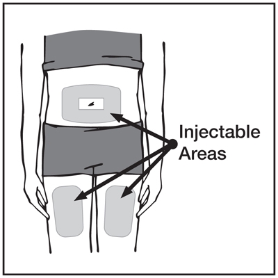 Injectable Areas