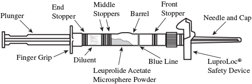 figure-1-luproloc-syringe
