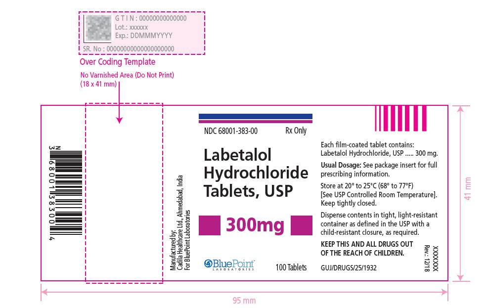 Labetalol HCl 300mg 100 count label - Rev 12-18.JPG