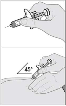 Figure L
