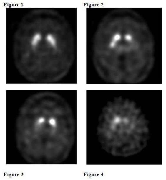 Figure 1,2,3,4