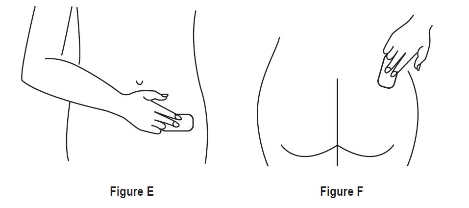 Figure E and F