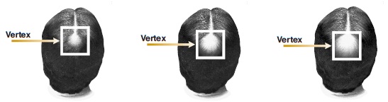 Vertex Image