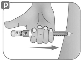 Instructions for Use Figure P