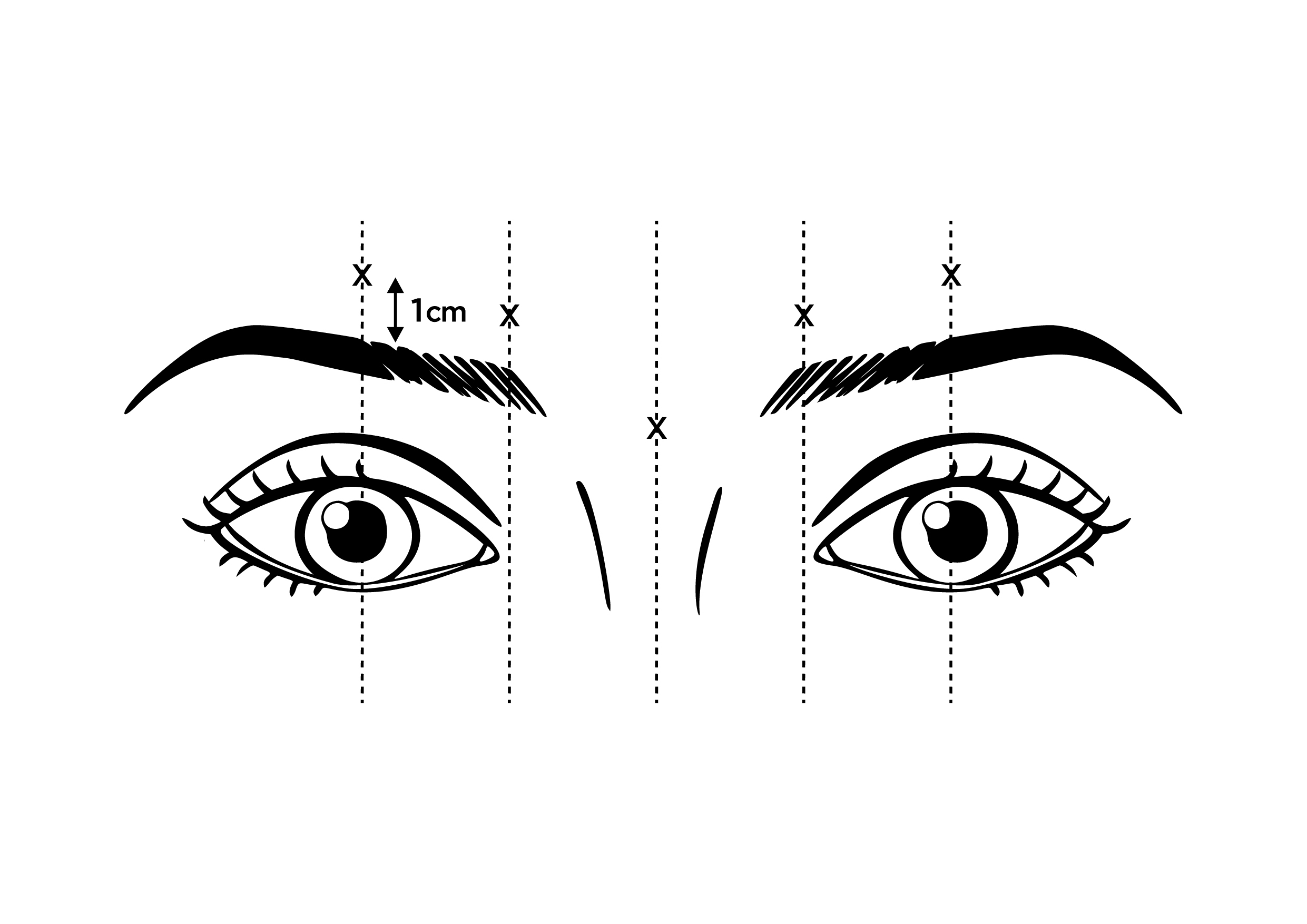 Figure 1:	LETYBO Sites (x) for Intramuscular Injection