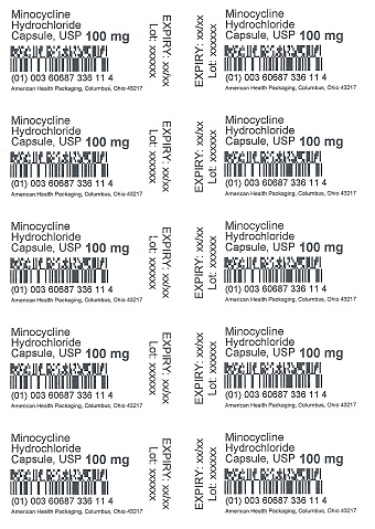 100 mg Minocycline HCl Capsule Blister