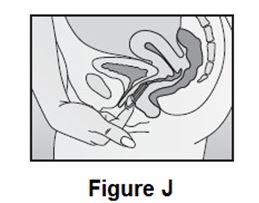 fig - f,g,h,i