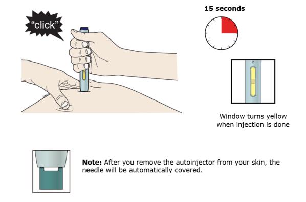 Keep pushing down on your skin. Then lift your thumb while still holding the autoinjector on your skin. Your injection could take about 15 seconds.