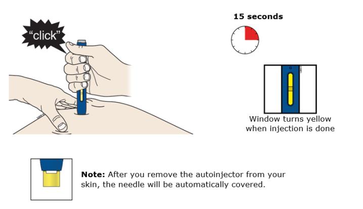 Keep pushing down on your skin. Then lift your thumb while still holding the autoinjector on your skin. Your injection could take about 15 seconds. 