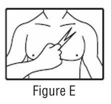 Figure E