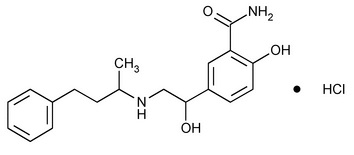 Comparison of adverse effects in Group I (labetalol) and Group II