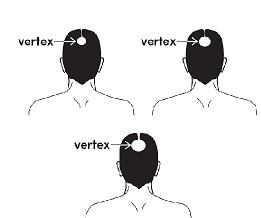 vertex image