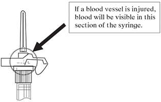 remove-if-blood-is-seen
