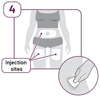 image of choosing injection site - AI instructions for use