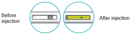 pen-step-8-before-after-injection