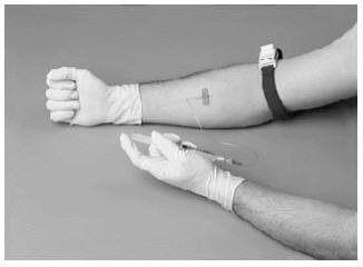 Remove and discard the filter needle from the syringe; attach a suitable needle. Use a winged infusion set if available..