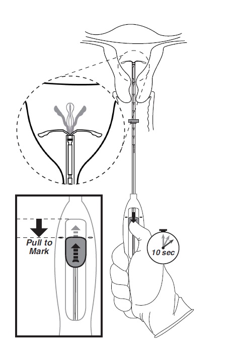 Fig 5