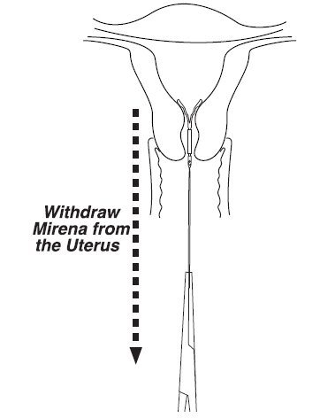 fig 9