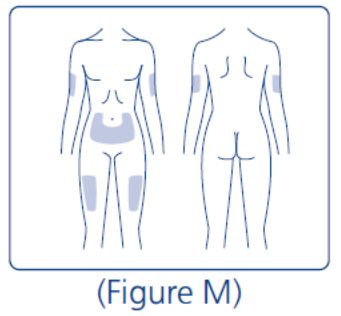 Step 11 Fig M