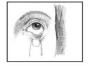 Open eyes, look up, and draw the lower lid of your eye down gently with your index finger to form a pocket between your eyelid and your eye (Figure 4).