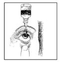 Hold the Timolol Maleate bottle upside down. Place dropper tip as close as possible to the lower eyelid and gently squeeze until a single drop is dispensed into the eye as directed by your doctor (Figure 5).