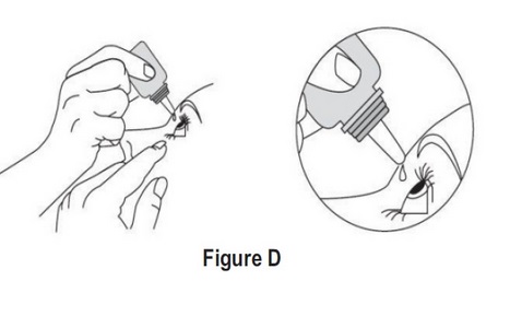 Dorzolamide-Timolol-SPL-Figure-D