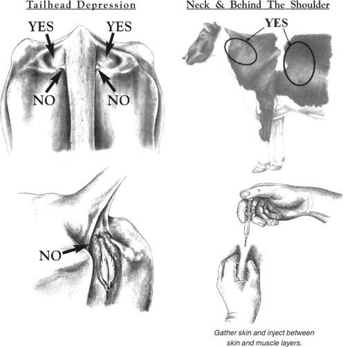 Injection Sites
