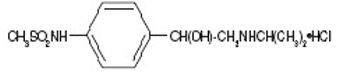 SOTALOL HYDROCHLORIDE tablet