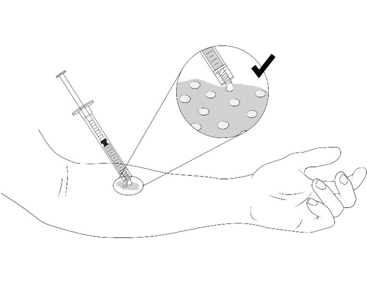 IFU-Fig1