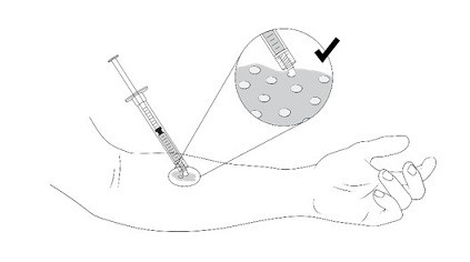 fig14
