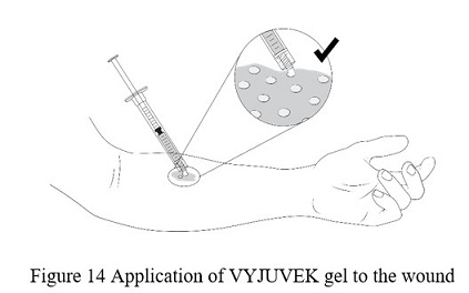 fig14